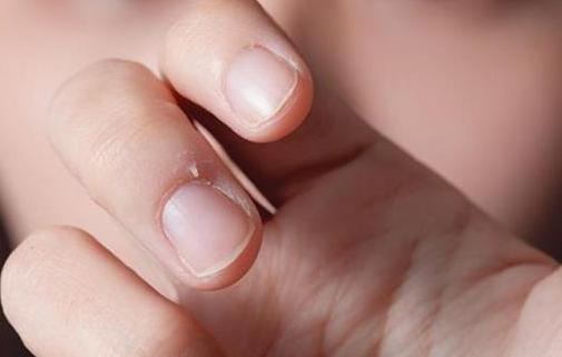 与手部其他部位的皮肤结构略有不同,覆盖甲板近端1/4处称为近端甲褶